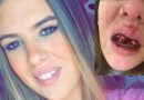 A dentist has offered to fix a young woman’s broken teeth for free after she was viciously punched unconscious at a house party